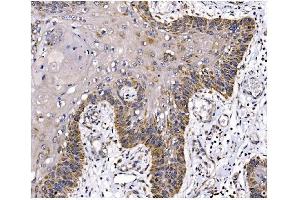 IHC analysis of PFKFB2 using anti-PFKFB2 antibody (ABIN7601627).