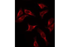 ABIN6272417 staining HeLa by IF/ICC. (RPS2 antibody  (C-Term))