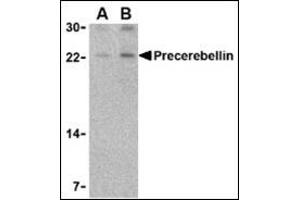 Western blot analysis of precerebellin in mouse cerebellum lysate with this product at (A) 2 and (B) 4 μg/ml.