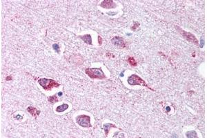Anti-TLL2 antibody  ABIN1049410 IHC staining of human brain, neurons and glia. (Tolloid-Like 2 antibody  (CUB2 Domain))