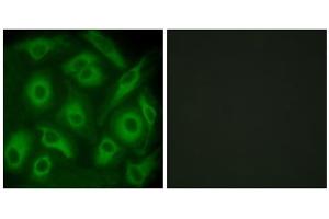 Immunofluorescence analysis of HeLa cells, using CDH23 antibody. (CDH23 antibody  (N-Term))
