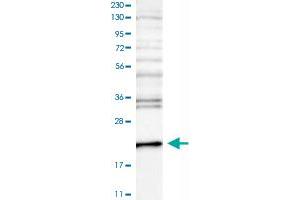Western Blot analysis of RT-4 cell lysate with CETN3 polyclonal antibody .