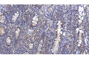 Detection of VF in Human Small intestine Tissue using Monoclonal Antibody to Visfatin (VF) (NAMPT antibody  (AA 1-491))