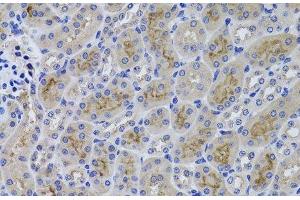 Immunohistochemistry of paraffin-embedded Mouse kidney using GGT1 Polyclonal Antibody at dilution of 1:100 (40x lens). (GGT1 antibody)