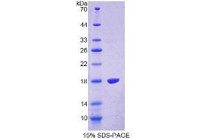 SDS-PAGE (SDS) image for Transient Receptor Potential Cation Channel, Subfamily V, Member 3 (TRPV3) (AA 671-790) protein (His tag) (ABIN6237469)