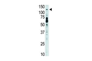 Antibody is used in Western blot to detect TLR7 in mouse liver tissue lysate. (TLR7 antibody  (N-Term))