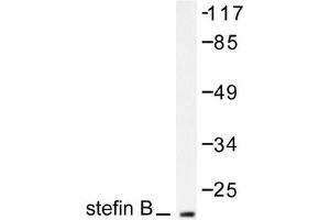 Image no. 1 for anti-Cystatin B (Stefin B) (CSTB) antibody (ABIN271833) (CSTB antibody)
