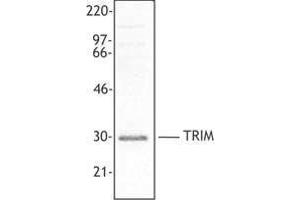 Western Blotting (WB) image for anti-T Cell Receptor Associated Transmembrane Adaptor 1 (TRAT1) (AA 29-186) antibody (ABIN2666376) (TRIM antibody  (AA 29-186))