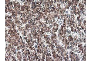 Image no. 7 for anti-Ribophorin 1 (RPN1) antibody (ABIN1500748)