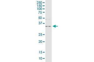 C10orf63 monoclonal antibody (M03), clone 2F10. (ENKUR antibody  (AA 1-256))