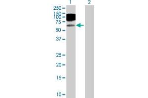Western Blot analysis of ICAM1 expression in transfected 293T cell line by ICAM1 MaxPab polyclonal antibody. (ICAM1 antibody  (AA 1-532))