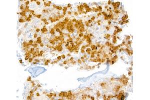Immunohistochemistry (IHC) image for anti-Lymphocyte Antigen 6 Complex, Locus G (Ly6g) antibody (ABIN7448893) (Ly6g antibody)