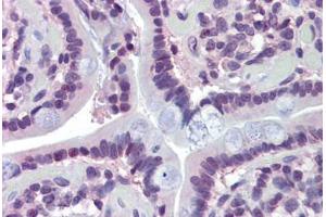Human Small Intestine (formalin-fixed, paraffin-embedded) stained with MAZ antibody ABIN462205 followed by biotinylated goat anti-rabbit IgG secondary antibody ABIN481713, alkaline phosphatase-streptavidin and chromogen. (MAZ antibody  (N-Term))