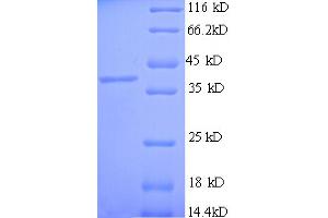 SDS-PAGE (SDS) image for Carboxypeptidase A3 (Mast Cell) (CPA3) (AA 110-417) protein (His tag) (ABIN5709315) (CPA3 Protein (AA 110-417) (His tag))