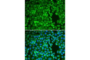 Immunofluorescence analysis of A549 cells using IDE antibody (ABIN5970800).
