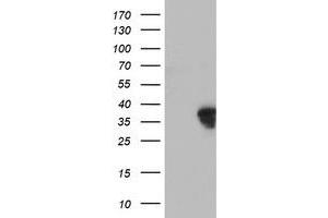 HEK293T cells were transfected with the pCMV6-ENTRY control (Left lane) or pCMV6-ENTRY HOXC11 (Right lane) cDNA for 48 hrs and lysed. (HOXC11 antibody  (AA 1-304))