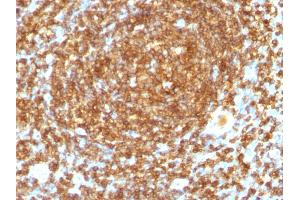 Immunohistochemistry (IHC) image for anti-Protein tyrosine Phosphatase, Receptor Type, C (PTPRC) antibody (ABIN6940442)