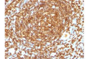 Formalin-fixed, paraffin-embedded human Tonsil stained with CD45RB Monoclonal Antibody (PTPRC/1132). (CD45 antibody)