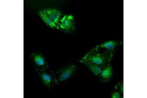 Immunofluorescence (IF) image for anti-alpha-Fetoprotein (AFP) (AA 19-397) antibody (ABIN2716008) (alpha Fetoprotein antibody  (AA 19-397))