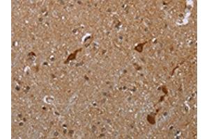 The image is immunohistochemistry of paraffin-embedded human brain tissue using ABIN7190062(CASP8AP2 Antibody) at dilution 1/20. (FLASH antibody)