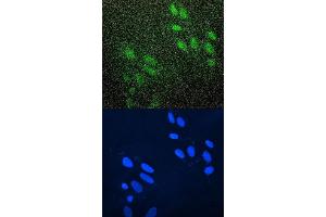 anti-Zinc Finger E-Box Binding Homeobox 1 (ZEB1) (Middle Region) antibody