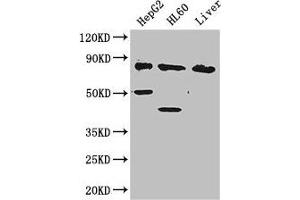 Western Blot Positive WB detected in: HepG2 whole cell lysate, HL60 whole cell lysate, Mouse liver tissue All lanes: PFKL antibody at 2. (PFKL antibody  (AA 229-479))