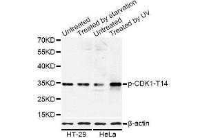 Western blot analysis of extracts of HT-29 and HeLa cells, using Phospho-CDK1-T14 antibody. (CDK1 antibody  (pThr14))