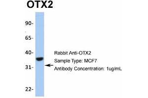 Western Blotting (WB) image for anti-Orthodenticle Homeobox 2 (OTX2) (N-Term) antibody (ABIN2779643)