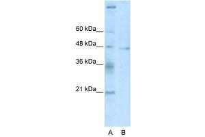 WB Suggested Anti-TSG101  Antibody Titration: 2. (TSG101 antibody  (C-Term))