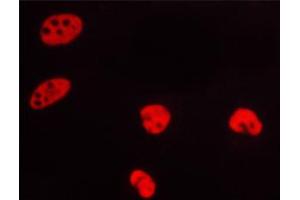 ABIN6267319 staining HeLa cells by ICC/IF. (Progesterone Receptor antibody  (pSer400))