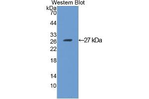 Western blot analysis of the recombinant protein. (ANGPTL1 antibody  (AA 270-490))