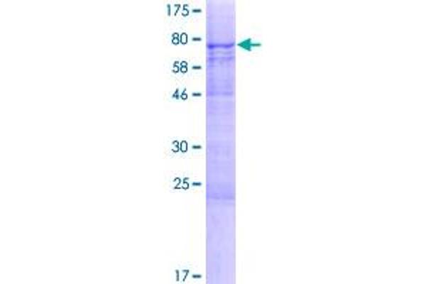 METTL14 Protein (AA 1-456) (GST tag)