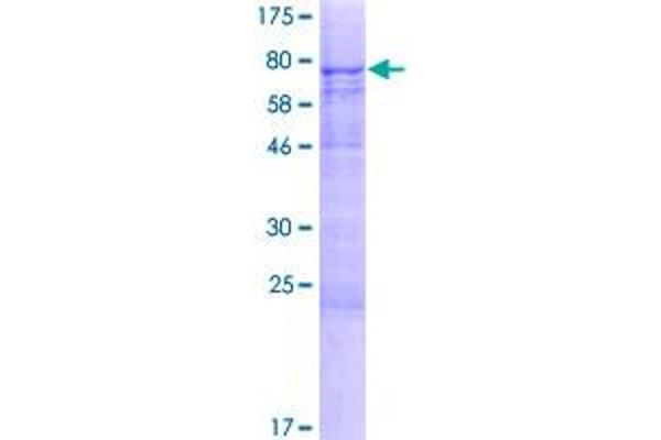 METTL14 Protein (AA 1-456) (GST tag)