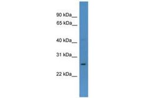 Image no. 1 for anti-Caudal Type Homeobox 1 (CDX1) (AA 31-80) antibody (ABIN6746144)