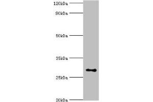 Western blot All lanes: Alpha-ketoglutarate-dependent dioxygenase alkB homolog 2 antibody at 2 μg/mL + Hela whole cell lysate Secondary Goat polyclonal to rabbit IgG at 1/10000 dilution Predicted band size: 30, 18 kDa Observed band size: 30 kDa (ALKBH2 antibody  (AA 1-261))