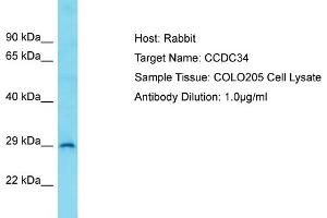 Host: Rabbit Target Name: CCDC34 Sample Type: COLO205 Whole Cell lysates Antibody Dilution: 1.