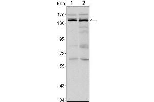 Western blot analysis using KDM3A mouse mAb against Hela (1) and HepG2 (2) cell lysate.