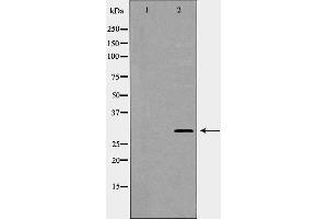 Western blot analysis of extracts of Hela lysate, using KLK2antibody. (Kallikrein 2 antibody)