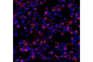 Immunofluorescence of paraffin embedded mouse lung using Dhcr24 (ABIN7072849) at dilution of 1: 650 (400x lens) (Seladin 1 antibody)