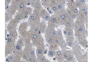 DAB staining on IHC-P; Samples: Human Liver Tissue (ARPC4 antibody  (AA 3-165))