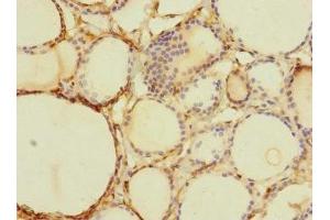 Immunohistochemistry of paraffin-embedded human thyroid tissue using ABIN7171903 at dilution of 1:100 (TTC12 antibody  (AA 1-260))