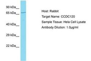 Image no. 1 for anti-Coiled-Coil Domain Containing 120 (CCDC120) (AA 329-378) antibody (ABIN6750717)