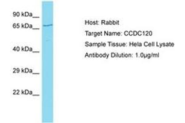 CCDC120 antibody  (AA 329-378)