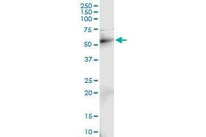 Immunoprecipitation of RAD18 transfected lysate using anti-RAD18 MaxPab rabbit polyclonal antibody and Protein A Magnetic Bead , and immunoblotted with RAD18 purified MaxPab mouse polyclonal antibody (B01P) . (RAD18 antibody  (AA 1-495))