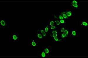 Immunofluorescent analysis of MCF-7 cells (sodium butyrate, 30 mM, 4h) using ABIN7139177 at dilution of 1:100 and Alexa Fluor 488-congugated AffiniPure Goat Anti-Rabbit IgG(H+L) (HIST1H1E antibody  (acLys33))