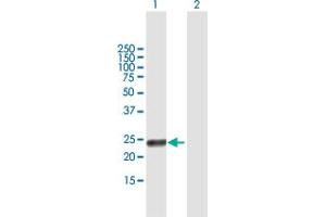 Western Blot analysis of RAET1G expression in transfected 293T cell line by RAET1G MaxPab polyclonal antibody.
