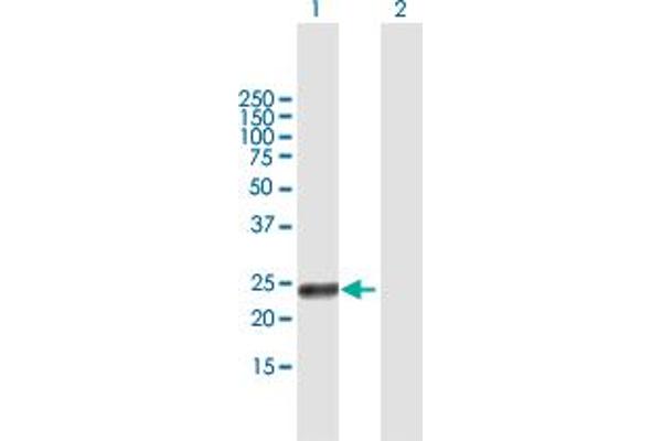 Retinoic Acid Early Transcript 1G (RAET1G) (AA 1-213) anticorps