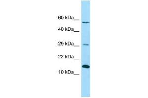 WB Suggested Anti-NDUFB4 Antibody Titration: 1. (NDUFB4 antibody  (C-Term))