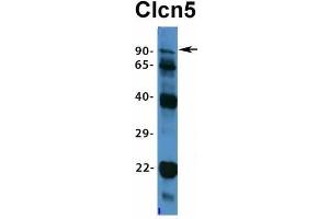 Western Blotting (WB) image for anti-Chloride Channel 5 (CLCN5) (Middle Region) antibody (ABIN2776081)