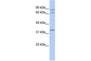 Image no. 1 for anti-Gap Junction Protein, alpha 4, 37kDa (GJA4) (AA 108-157) antibody (ABIN6740499)